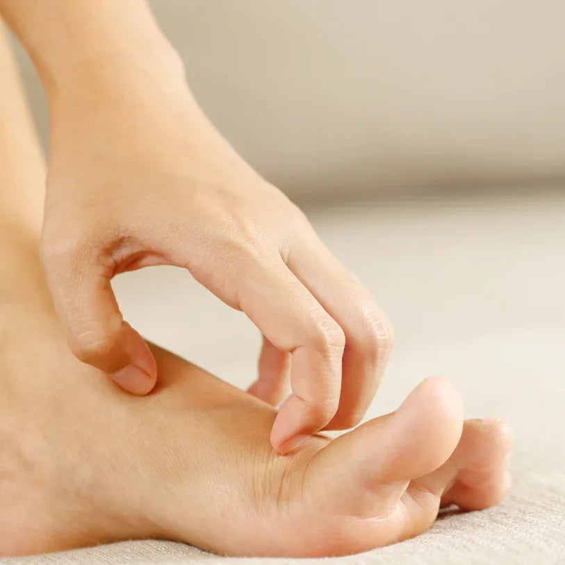 Antifungal - Underground Allure